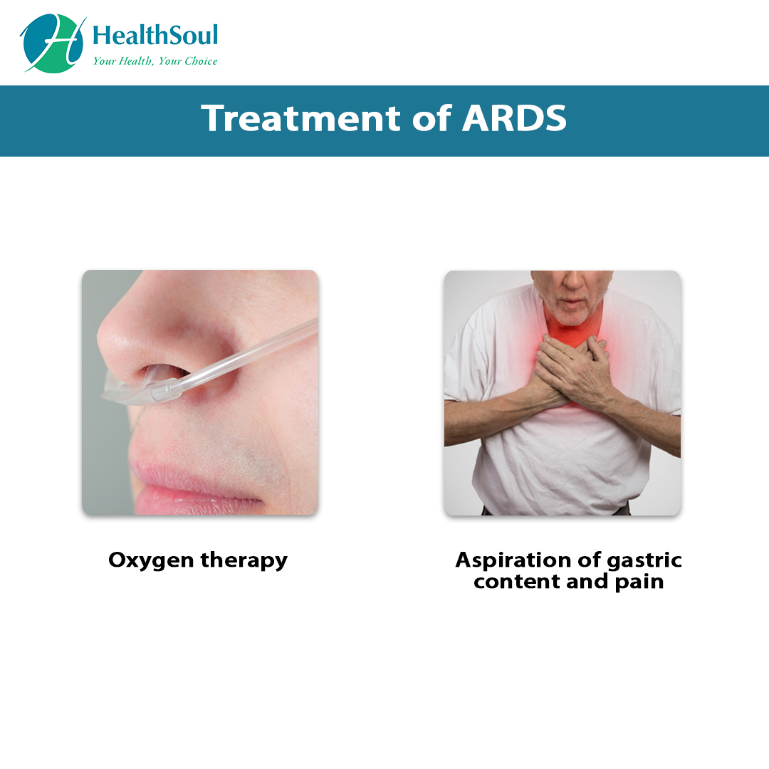 Acute Respiratory Distress Syndrome: Symptoms and Treatment – Healthsoul