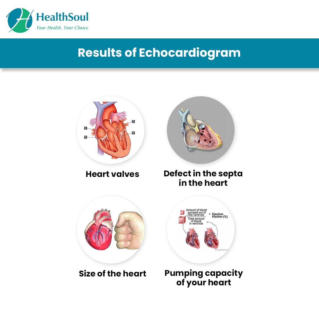 What do echocardiogram colors mean The Meaning Of Color