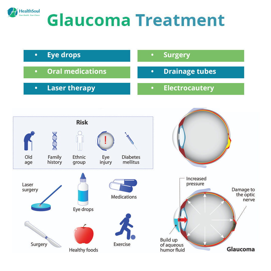 Medications to treat glaucoma