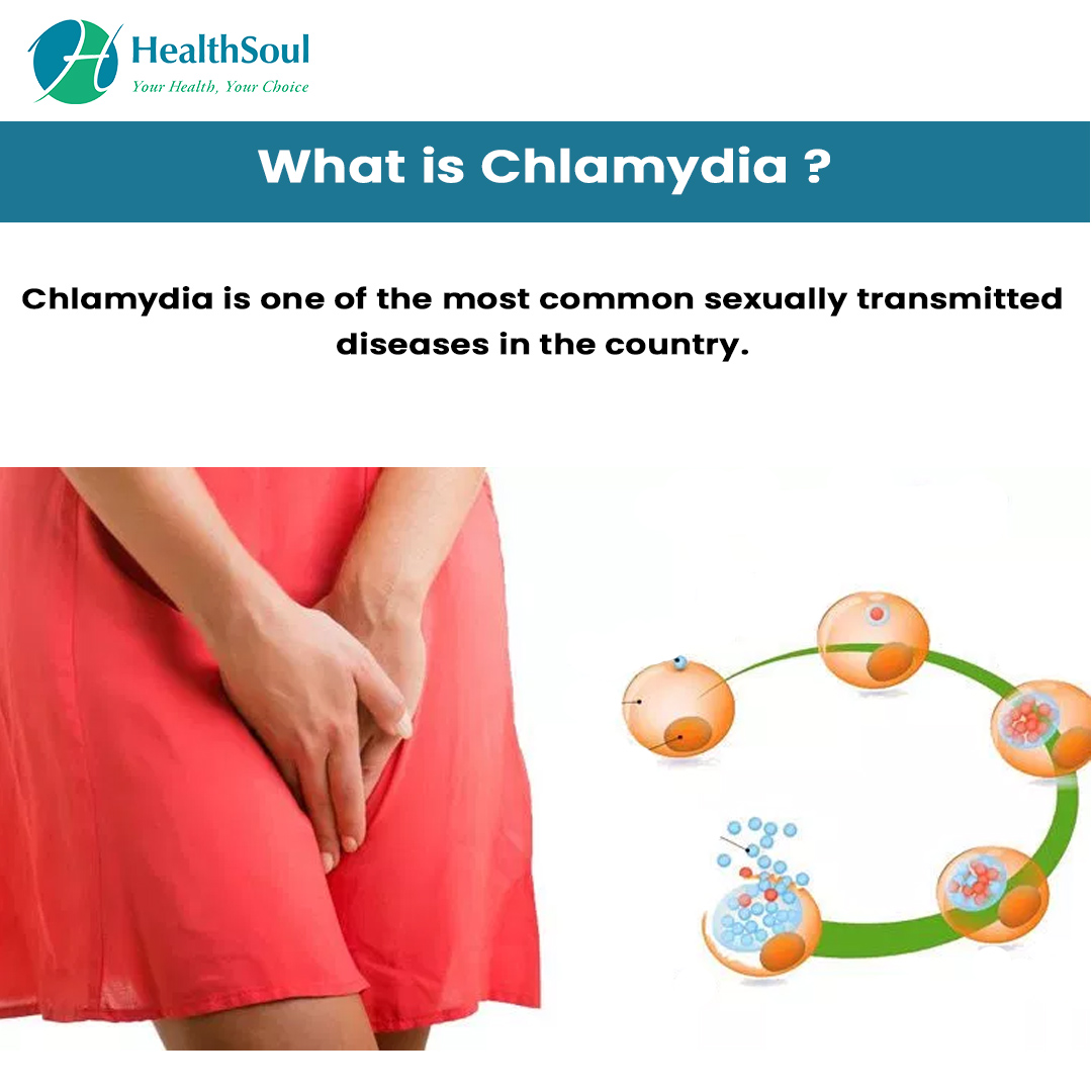 Chlamydia Symptoms And Treatment Healthsoul