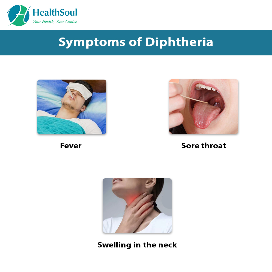 Diphtheria: Symptoms and Treatment | Internal Medicine | HealthSoul