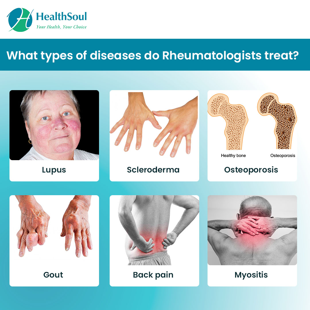 Learn about Rheumatologists Diseases they treat and When